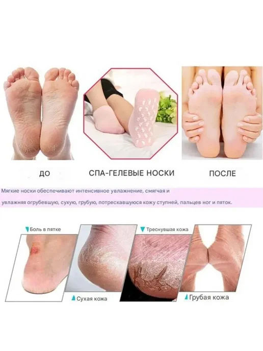 Гелевые увлажняющие SPA носки для педикюра цвет рандом, вариант, фото 6