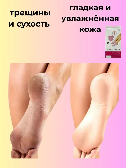 САРЫ спа носки для ухода за пятками ног, серый, фото 3