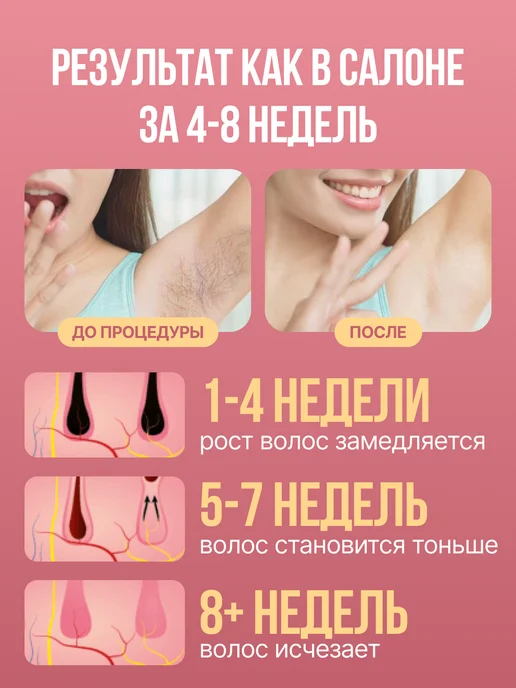LUM AUS Фотоэпилятор для удаления волос домашний, белый, фото 2