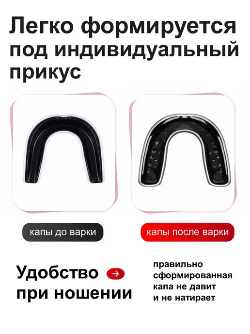 Нет бренда Капа спортивная боксерская для зубов взрослая, вариант, фото 5