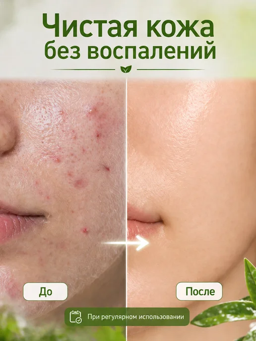 VITATEKA Масло чайного дерева натуральное 10 мл, 10 мл, фото 5