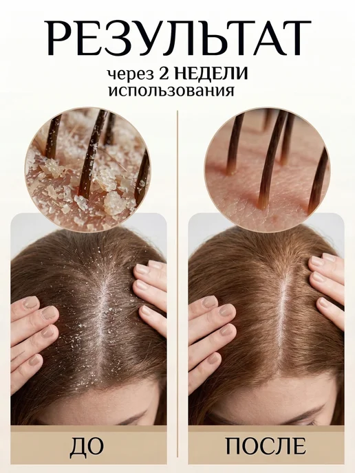 MIREAU Шампунь для волос против перхоти и себореи, 250 мл, фото 2