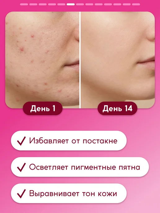 Semily Тоник для лица очищающий гликолевый 200 мл, 200 мл, фото 6