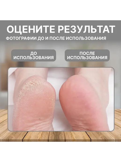 Пемза для ног для идеального ухода за стопами Голубой, голубой, фото 4