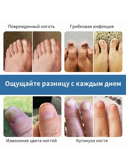 Средство для ногтей и кутикулы 30мл, 30 мл, фото 10