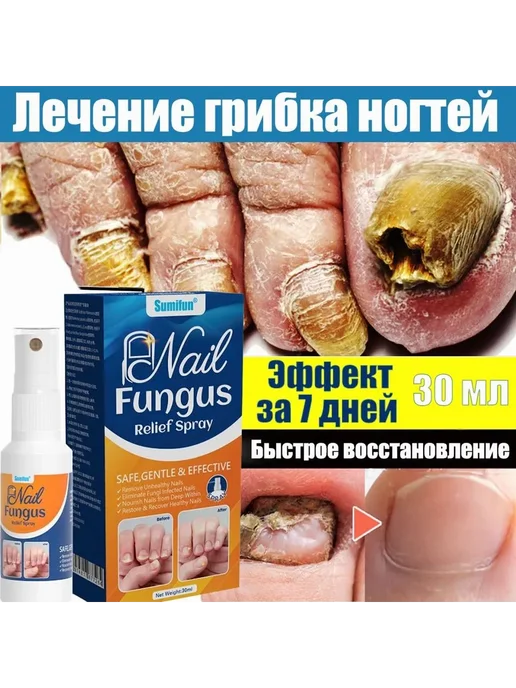 Средство для ногтей и кутикулы 30мл, 30 мл, фото 3