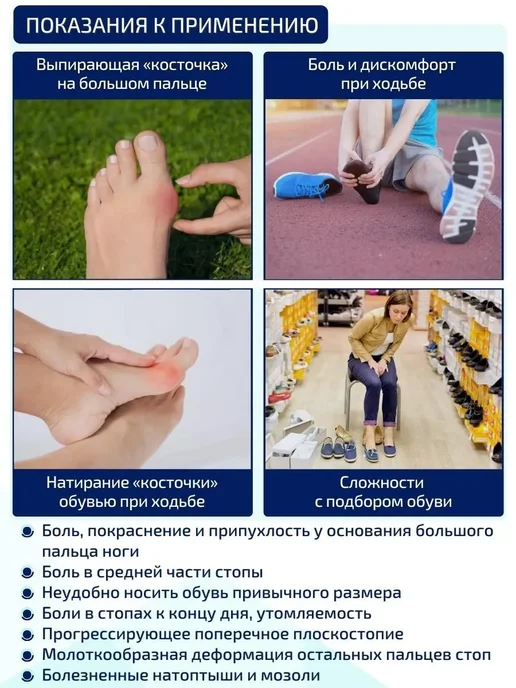 Тренажер-выпрямитель для пальцев ног при вальгусной деформац, вариант, фото 5