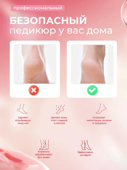 Электрическая пилка для пяток ног аппарат для педикюра, розовый, фото 3