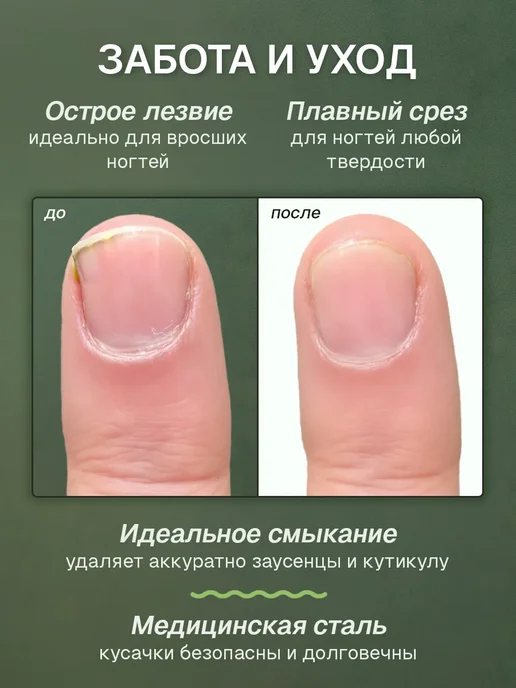 Alazur Щипцы для ногтей кусачки педикюрные, вариант, фото 2