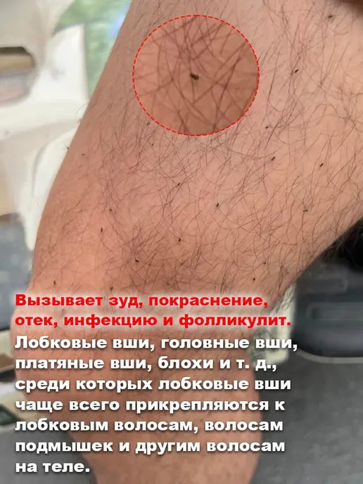Крем для депиляции тело + лицо + интим. Эффективно и быстро, вариант, фото 4