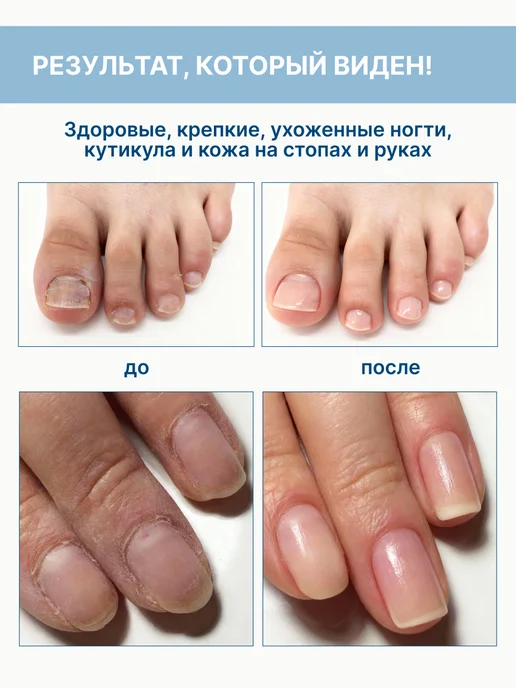 A'pich Сыворотка для ногтей регенерирующая стоп онихолизис, белый, фото 3