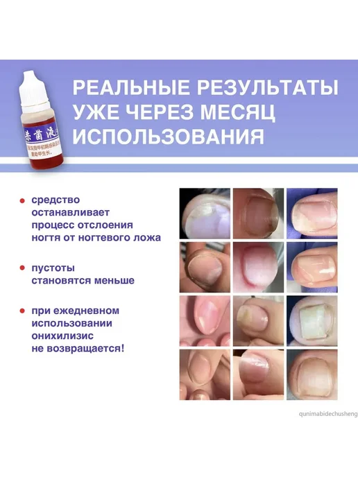 Средство для ногтей и кутикулы 10мл 50г, 10 мл, 50 г, фото 5